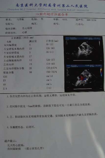 45챦5mmȱ